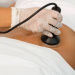 Close up of a woman getting a cavitation treatment